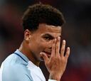 FIFA sancionaría duramente a Dele Alli por gesto obsceno