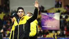 Marc Bartra enseña las heridas que le dejó el atentado