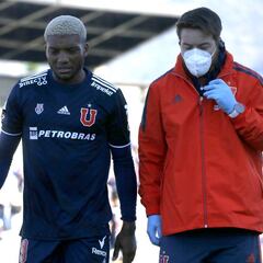 La U sufre 5 sensibles bajas en el duelo ante Antofagasta