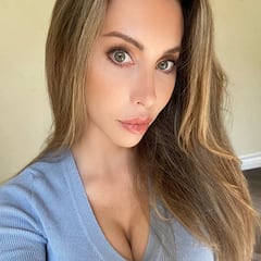 La hija de Olivia Newton-John pone fin a su “adicción a la cirugía” tras las críticas