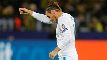 El Madrid reconoce la lesión de Bale en el sóleo; no hay rotura