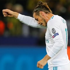 El Madrid reconoce la lesión de Bale en el sóleo; no hay rotura