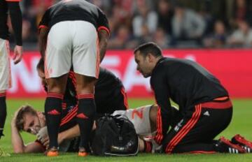 Las imágenes de la fractura de tibia de Luke Shaw