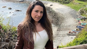 Las duras consecuencias de Loreto Aravena tras una picadura de araña de rincón