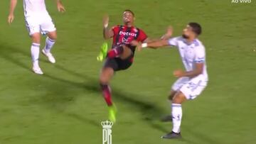 Una anotación dentro del área estéticamente espectacular.