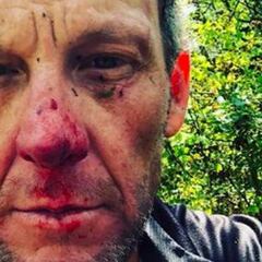 Armstrong sufre una dura caída: su rostro lo dice todo