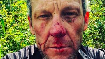 Armstrong sufre una dura ca¨ªda: su rostro lo dice todo