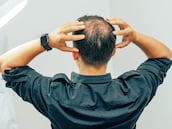 Ni minoxidil ni lociones: el champú con cafeína Nº1 en Amazon que previene la caída del cabello