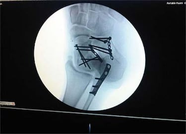 Algo pasa con Rossi y ánimos para Fonsi