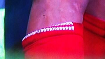 Así quedó la pierna de Luis Suárez tras la entrada de Mirallas