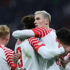 El Leipzig es un dolor de muelas