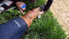 Disc brake injury slices Ventoso's leg open on Paris-Roubaix