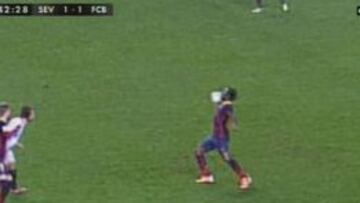 La mano que debió ser la segunda de Song.