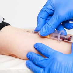 ¿Puedo beber agua antes de un análisis de sangre? El motivo del ayuno previo a una analítica