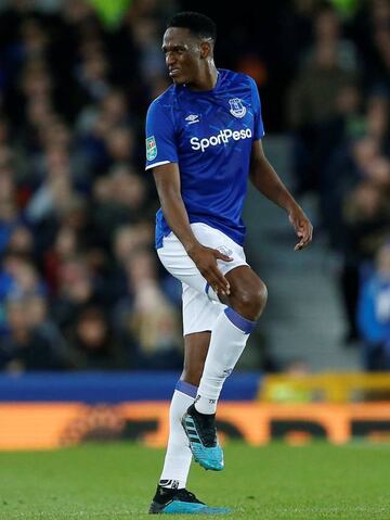 Momento en el que Yerry Mina se lesiona frente al Watford