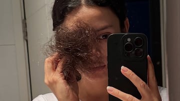 “Que se nos caiga el pelo es una de las cosas más fuertes de la quimioterapia... Te hace mirar el cáncer frente al espejo”