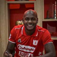 Víctor Ibarbo confirma que va a ser operado y desconoce si volverá