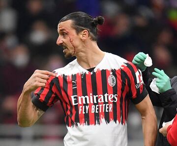 El chileno Gary Medel y el sueco Zlatan Ibrahimovic protagonizaron un fuerte choque durante el partido entre el AC Milan y el Bolonia. Los dos jugadores quedaron tendidos en el césped, sangrando. Necesitaron de asistencia médica para poder incorporarse.
