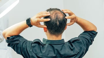 Ni minoxidil ni lociones: el champú con cafeína Nº1 en Amazon que previene la caída del cabello