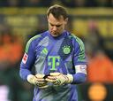 El Bayern pierde a Neuer hasta 2025