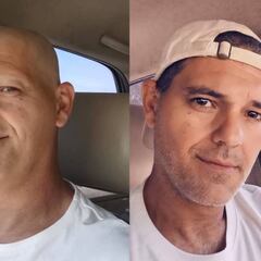 Frank Cuesta reaparece sin pelo y podría haber recaído del cáncer que sufrió