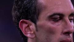 Suárez elbows Godín, leaves him with black eye