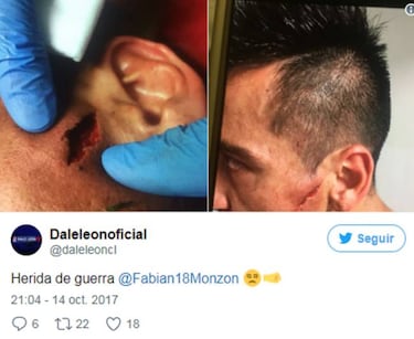 Monzón sufre impactante corte en duelo con Antofagasta