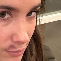 El accidente de María Pombo durante su mudanza: “Me lo clavé en la cara”