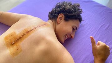 La cicatriz de Ana Carrasco.