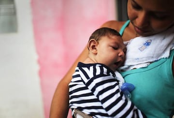 (Recife, Brasil) Daniele sujeta a su bebé, Juan Pedro, que sufre microcefalia