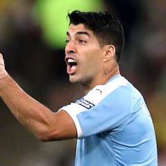 Suárez jugó con un dedo fracturado ante Chile y Perú