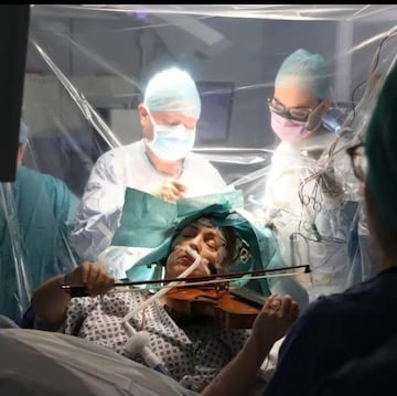 Cirugía operación craneotomía pacientes despiertos