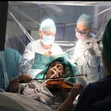 Despierto en plena operación de cerebro: el curioso método para no fallar una craneotomía