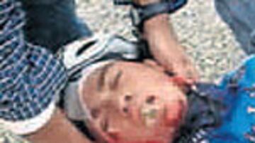 Momento en el que Contador era atendido tras el accidente.