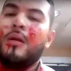 'La Voz': concursante sube un vídeo tras recibir varios disparos