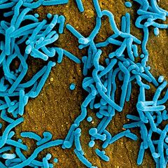 El posible caso de virus de Marburgo que obliga a activar el protocolo de enfermedades hemorrágicas