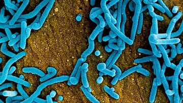 El posible caso de virus de Marburgo que obliga a activar el protocolo de enfermedades hemorr¨¢gicas