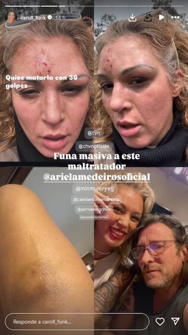 Ex chica Mekano denuncia que fue agredida por su pareja: “Llamé a Carabineros y logró darse a la fuga”