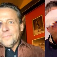 Alfredo Adame: ¿Qué ha pasado con su ojo y qué dicen los médicos?