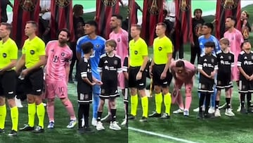 El video que muestra que Messi jugó con molestias ante Atlanta