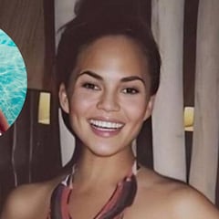 Chrissy Teigen comparte en topless sus quemaduras después de tomar el sol
