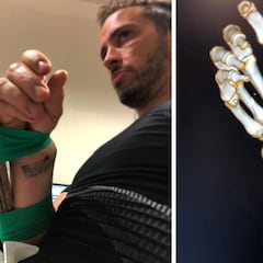 Escalofriante lesión de Dovizioso