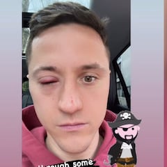 La reacción de la mujer de Ander Herrera al ver la infección del jugador en el ojo