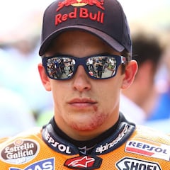 "¿Márquez? Uno que ha visto la muerte en su cara y piensa en volver a la moto de inmediato"