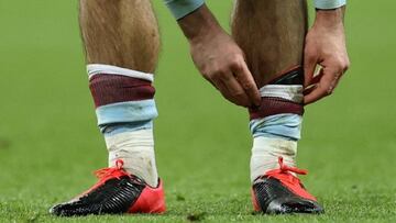 Inglaterra convoca al futbolista que usa espinilleras de niño