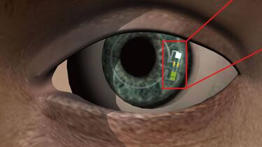 Así son las lentillas que miden la glucosa a través de las lágrimas