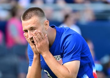 United States defender Kristoffer Lund reacts after missing a shot on goal against Canada.