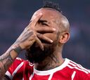Alarma en el Bayern: Vidal se lesiona y se marcha en camilla