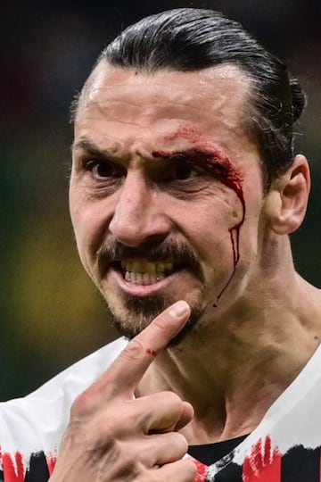 El chileno Gary Medel y el sueco Zlatan Ibrahimovic protagonizaron un fuerte choque durante el partido entre el AC Milan y el Bolonia. Los dos jugadores quedaron tendidos en el césped, sangrando. Necesitaron de asistencia médica para poder incorporarse.
