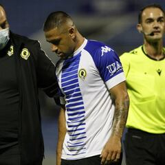 Otro susto del 'Toro' Acuña: puede tener dañado el peroné